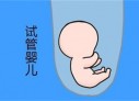 培养郑州捐卵宝宝艺术细胞的小技巧